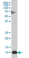1 - SNAPC5 Antibody (monoclonal) (M07) AT3978a