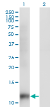 1 - SNAPC5 Antibody (monoclonal) (M07) AT3978a