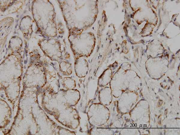 2 - SOCS5 Antibody (monoclonal) (M01) AT3990a