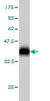 1 - SOCS5 Antibody (monoclonal) (M01) AT3990a