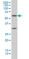 1 - SOCS5 Antibody (monoclonal) (M01) AT3990a