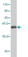 1 - SOX13 Antibody (monoclonal) (M01) AT3994a