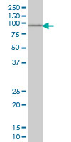 1 - SOX13 Antibody (monoclonal) (M01) AT3994a