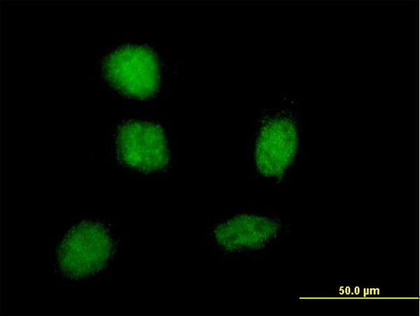 3 - SOX21 Antibody (monoclonal) (M01) AT3996a
