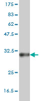 1 - SOX21 Antibody (monoclonal) (M01) AT3996a