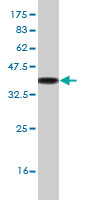 1 - SOX3 Antibody (monoclonal) (M04) AT3997a