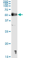 5 - SOX9 Antibody (monoclonal) (M02) AT4001a