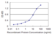 10 - SP100 Antibody (monoclonal) (M02) AT4006a