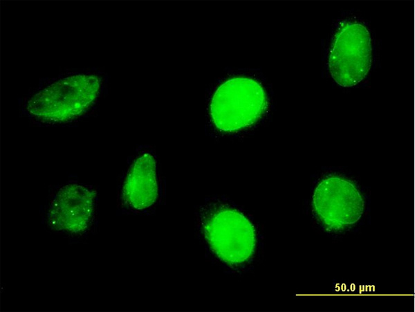 3 - SP110 Antibody (monoclonal) (M02) AT4007a