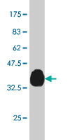 1 - SP110 Antibody (monoclonal) (M02) AT4007a