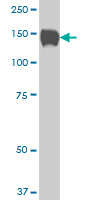 1 - SP110 Antibody (monoclonal) (M02) AT4007a