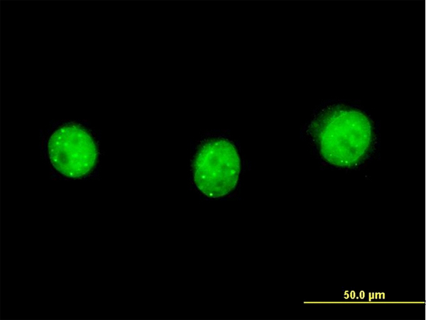 3 - SP110 Antibody (monoclonal) (M03) AT4008a