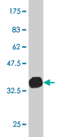 1 - SP110 Antibody (monoclonal) (M03) AT4008a