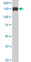 1 - SP110 Antibody (monoclonal) (M03) AT4008a
