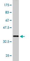 1 - SPAG5 Antibody (monoclonal) (M01) AT4012a