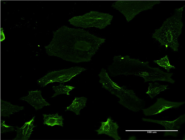 3 - SPAST Antibody (monoclonal) (M02) AT4016a
