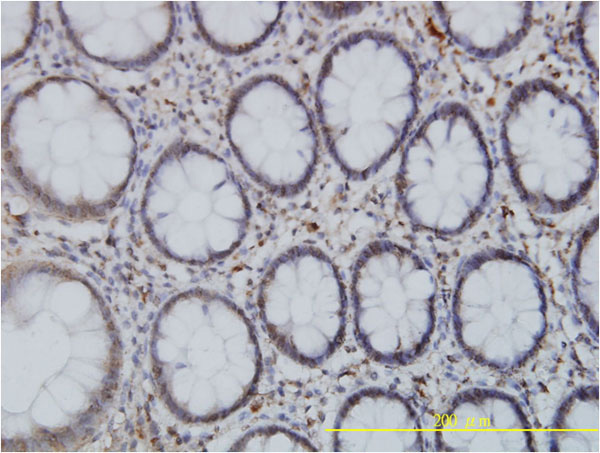 2 - SPAST Antibody (monoclonal) (M02) AT4016a