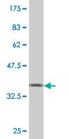 1 - SPAST Antibody (monoclonal) (M02) AT4016a