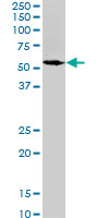 1 - SPAST Antibody (monoclonal) (M02) AT4016a