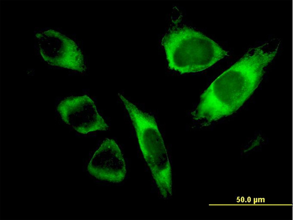 3 - SPATA2 Antibody (monoclonal) (M01) AT4017a