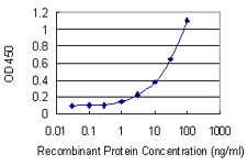 10 - SPDEF Antibody (monoclonal) (M01) AT4018a