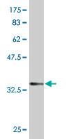 1 - SPDEF Antibody (monoclonal) (M01) AT4018a