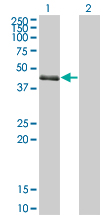 1 - SPDEF Antibody (monoclonal) (M01) AT4018a