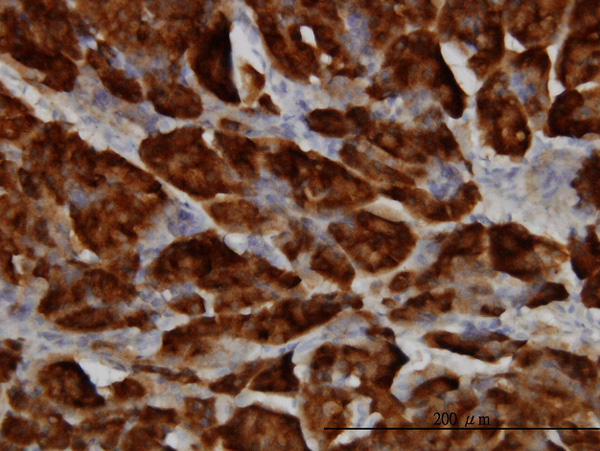 2 - SPINK1 Antibody (monoclonal) (M01) AT4023a