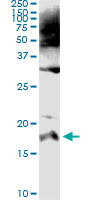 5 - SPINK1 Antibody (monoclonal) (M01) AT4023a