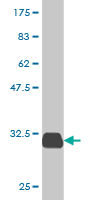 1 - SPINK1 Antibody (monoclonal) (M01) AT4023a
