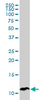 1 - SPINK1 Antibody (monoclonal) (M01) AT4023a