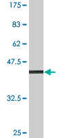 1 - SPINLW1 Antibody (monoclonal) (M02A) AT4024a