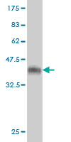 1 - SPIRE1 Antibody (monoclonal) (M01) AT4025a