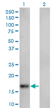 1 - SPIRE1 Antibody (monoclonal) (M01) AT4025a