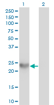 1 - SPRR3 Antibody (monoclonal) (M01) AT4030a