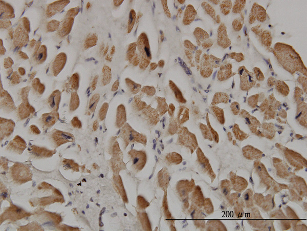 2 - SPRY1 Antibody (monoclonal) (M01) AT4031a