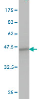 1 - SPRY1 Antibody (monoclonal) (M01) AT4031a