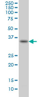 1 - SPRY1 Antibody (monoclonal) (M01) AT4031a