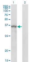 1 - SPRY1 Antibody (monoclonal) (M01) AT4031a