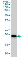 1 - SRI Antibody (monoclonal) (M01) AT4040a