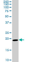1 - SRI Antibody (monoclonal) (M01) AT4040a