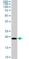 1 - SRI Antibody (monoclonal) (M01) AT4040a