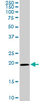 1 - SRI Antibody (monoclonal) (M01) AT4040a