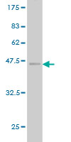 1 - SSR4 Antibody (monoclonal) (M01) AT4047a