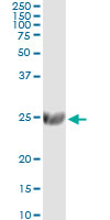 5 - ST6GAL1 Antibody (monoclonal) (M01) AT4052a