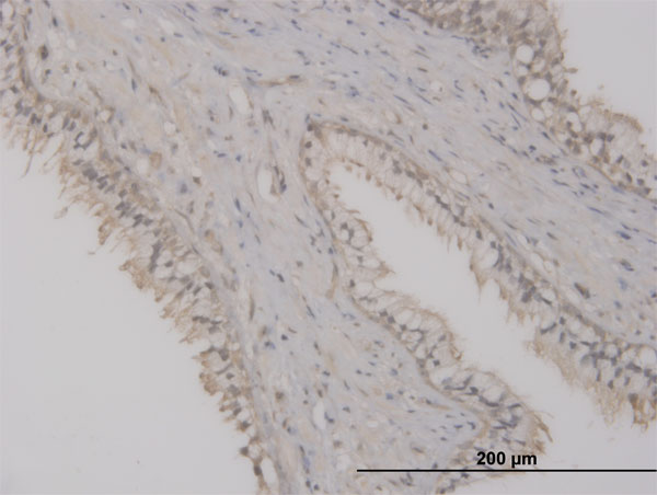 2 - ST8SIA2 Antibody (monoclonal) (M01) AT4053a