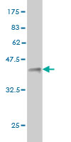 1 - ST8SIA2 Antibody (monoclonal) (M01) AT4053a