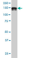 1 - STAG2 Antibody (monoclonal) (M01) AT4056a