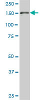 1 - STAG2 Antibody (monoclonal) (M01) AT4056a