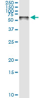 5 - STIP1 Antibody (monoclonal) (M01) AT4076a